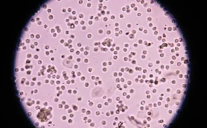 White Blood Cells and Blood in Dog's Urine: What You Need to Know