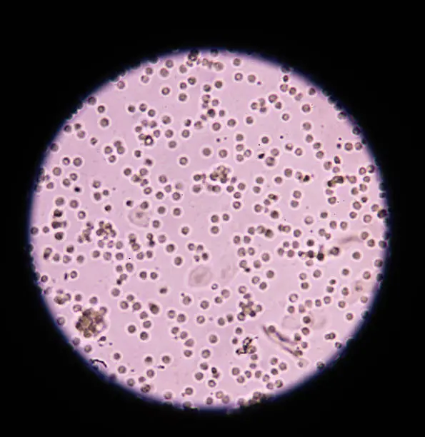 White Blood Cells and Blood in Dog’s Urine: What You Need to Know